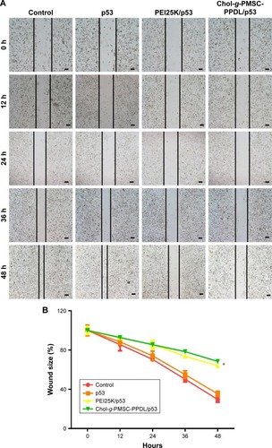 Figure 8 Wound healing assay of PC-3 cells after p53 transfection for different time (A) and the quantitative analysis of wound size (B). Notes: Data are presented as mean value ± SD of triplicate experiments. *P<0.05. The scale bar is 100 µm.Abbreviation: PEI25K, poly(ethylenimine) with a weight-average molecular weight of 25,000 g/mol.