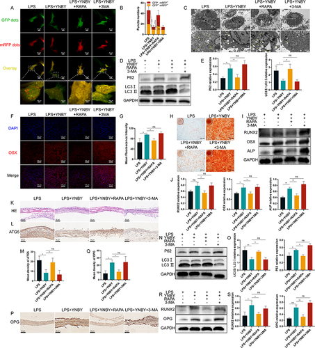 Figure 4 YNBY promotes osteogenic differentiation by inhibiting inflammation-induced autophagy. (A and B) Autophagic flux detection for MC3T3-E1 cells transfected with adenovirus expressing mRFP-GFP-LC3 (A) and quantitative analysis (B); scale bar, 20 μm; n=30. (C) Transmission electron microscopy of MC3T3-E1 cells; low-magnification scale bar, 2 μm; high-magnification scale bar, 500 nm. (D and E) Western blot (D) and quantification (E) of autophagy in MC3T3-E1 cells; n=3. (F and G) Immunofluorescence staining (F) and quantitative analysis (G) of OSX in MC3T3-E1 cells; scale bar, 50 μm; n=3. (H) Alizarin Red staining of MC3T3-E1 cells; scale bar, 200 μm; n=3. (I and J) Western blot (I) and quantification (J) of RUNX2, OSX and ALP in MC3T3-E1 cells; n=3. (K and L) Representative H&E staining (K) and immunohistochemical staining of ATG5 (L) in calvaria; scale bar, 50 μm. (M) Quantitative analysis of the immunohistochemistry in L, n=3. (N and O) Western blot (N) and quantificational analysis (O) of autophagy in calvaria; n=3. (P and Q) Immunohistochemical staining (P) and quantitative analysis (Q) of OPG in calvaria; scale bar, 50 μm; n=3. (R and S) Western blot (R) and quantificational analysis (S) of RUNX2 and OPG in calvaria; n=3. Data are expressed as the mean ± SD; *p < 0.05; **p < 0.01; ***p < 0.001; ****p < 0.0001, ns = not significant.