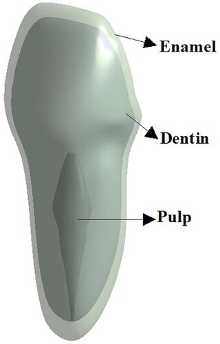 Figure 1. Dental model – frontal incisor.
