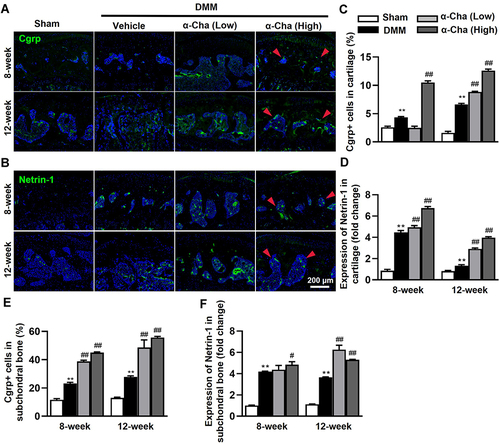 Figure 5 α-Chaconine recruits sensory nerve ingrowth in subchondral bone. (A and B) Immunofluorescence staining of Cgrp and Netrin-1 in subchondral bone 8- and 12-Week post-surgery. (C and D) Quantification of Cgrp-positive cells and positive staining of Netrin-1 in cartilage. (E and F) Quantification of Cgrp-positive cells and positive staining of Netrin-1 in subchondral bone. Red arrows indicated Cgrp-positive neurons and positive expression of Netrin-1. Data were expressed as the mean ± SD. **P < 0.01 vs Sham group, #P < 0.05, ##P < 0.01 vs Vehicle group.