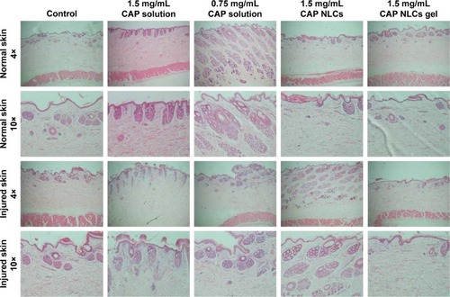Figure 7 HE staining of the dorsal skin of rabbits treated with different capsaicin-based formulations and different concentrations.Abbreviations: HE, hematoxylin and eosin; NLCs, nanolipoidal carriers; CAP, capsaicin.