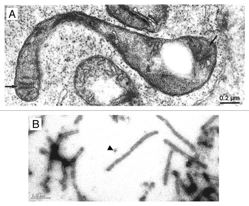 Figure 2. Common features of microtubule-like structures (MTLs) and VIPP1 rings/rods. (A) Electron microscopy image of a microtubule-like structure (arrow) within a young spinach chloroplast. From Lawrence and Possingham (1984).Citation15 (B) Electron microscopy image after negative staining of recombinant Chlamydomonas VIPP1. The arrowhead indicates a VIPP1 ring. The scale is the same as that in Figure 2A.