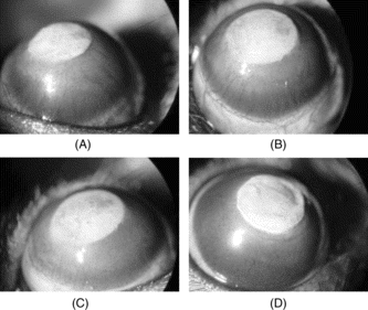 Figure 1 Photographs of the rat corneas 7 days after silver nitrate cauterization showing new vessels invading the cornea (magnification, × 16). Note the degree of neovascularization, after topical isotonic saline (control) (A), after topical treatment with 0.1% RUS (B), after topical treatment with 1% RUS (C), and after topical treatment with 10% RUS (D).