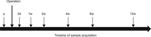 Figure 1 A timeline of the protocol for taking blood samples throughout this study.Notes: Blood was drained from each patient 1d p and 2d, 1w, 2w, 4w, 6w, and 12w after surgery.Abbreviations: p, preoperative; d, day(s); w, week(s).