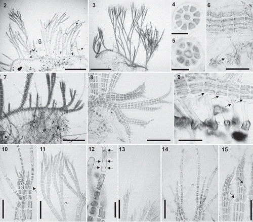 Figs 2–15. Vertebrata cymatophila (2, 4, 7, 10, 12–14) and V. barbarae sp. nov. (3, 5, 6, 8, 9, 11, 15): Vegetative morphology. Figs 2–3. Habit of a specimen with prostrate and erect axes. Figs 4–5. Cross section of an axis with nine (Fig. 4) and eight (Fig. 5) pericentral cells. Fig. 6. Prostrate axis with a rhizoid terminated in a digitate discoid pad (arrow) and a thick wall. Fig. 7. Prostrate axis with abundant rhizoids on every segment. Fig. 8. Apices of prostrate axes lacking trichoblasts. Fig. 9. Rhizoids cut off from pericentral cells (arrows). Fig. 10. Branch formed in the axil of trichoblasts (arrow). Fig. 11. Erect axes pseudodichotomously branched. Fig. 12. Trichoblast cell with multiple nuclei (arrows). Fig. 13. Apices of erect axes with long unbranched trichoblasts. Fig. 14. Apices of erect axes with spirally arranged trichoblasts. Fig. 15. Apices of erect axes with scar cells of trichoblasts (arrows). Scale bars: Figs 2–3 = 700 µm; Figs 4–5, 12 = 30 µm; Figs 6, 9, 10, 14, 15 = 80 µm; Figs 7, 11, 13 = 300 µm; Fig. 8 = 160 µm