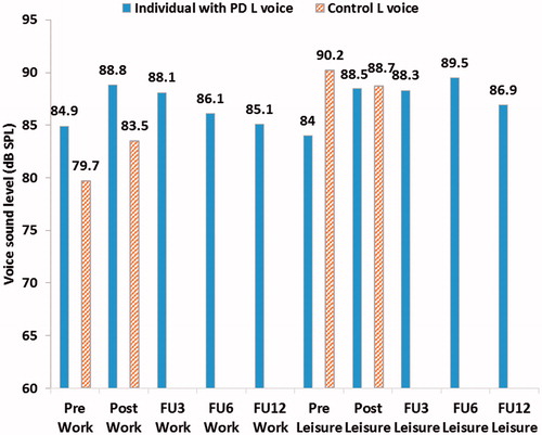 Figure 2. Mean voice sound level (Lvoice) and mean environmental noise sound level (Lnoise) during the different monitoring periods with data presented for leisure and work activities respectively for both participants (vertical mouth-to-microphone distance of approximately 10 cm).