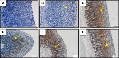 Figure 8 HSP70 IHC.