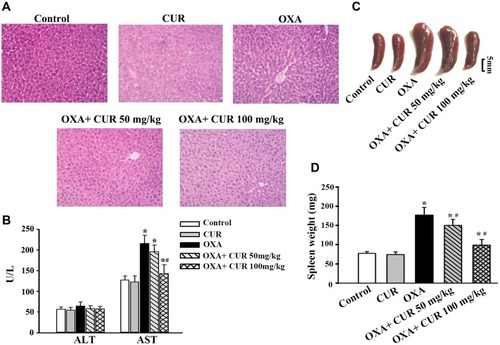 Figure 2 CUR attenuates OXA-induced liver injury and splenomegaly. Mice were randomly classified into five groups: (1) Control group: administered with 5% glucose; (2) CUR group: treated orally with CUR via gavage; (3) OXA group: treated with OXA on a weekly basis; (4) OXA+CUR 50 mg/kg group: treated with OXA (as OXA group) plus CUR (50 mg/kg, 30 min before and three consecutive days after every OXA injection); and (5) OXA+CUR 100 mg/kg group: treated with OXA (as OXA group) plus CUR (100 mg/kg, 30 min before and three consecutive days after every OXA injection). After treatment for eight weeks, the mice were euthanized one week following the final dose of OXA. (A) Liver histopathology was examined in each group three days after the final OXA dose (H&E staining, original magnification: 100×). (B) The serum ALT and AST levels of each group were evaluated three days after the final OXA dose. (C) Representative images of the spleens of each group. (D) The spleen weight of each group. The results are presented as the mean ± standard deviation of five mice from each group. *P<0.05 vs control group, #P<0.01 vs OXA group.