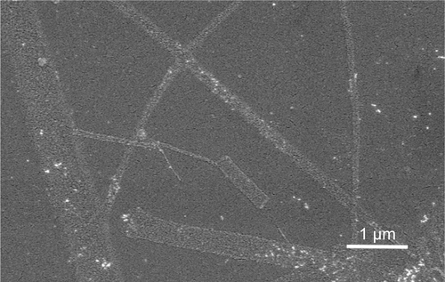 Figure S1 Representative scanning electron micrographs of SNF-PDL on Day 15.Abbreviation: SNF-PDL, poly-d-lysine-treated silica nanofiber.