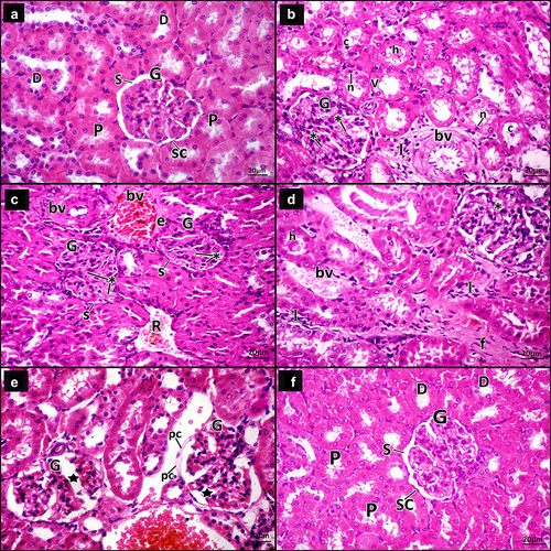 Figure 4. A photomicrograph for H&E-stained sections in adult male rats’ renal cortex. a Control group, the glomerulus (g) appears normal, Bowman’s capsule is lined by simple squamous cells (SC) and Bowman’s space (s) appears narrow. Proximal (p) and distal convoluted tubules (d) are seen. b–e DN group. b The glomerulus (G) shows mesangial expansion (*). Some tubules have vacuolated lining cells (v), small dark nuclei (n) and hyaline (h) and cellular (c) casts within their lumen. The interstitium shows infiltrating mononuclear inflammatory cells (i) and thickened blood vessels (bv). c The glomeruli (G) show mesangial expansion (*) and narrow Bowman’s space (s). The interstitium shows congested blood vessel (bv) surrounded by an exudate (e), a blood vessel with thickened wall (bv) and extravasated red blood cells (r). d The glomeruli (G) appear segmented with mesangial expansion (*). The tubules have hyaline (h) casts within their lumen. The interstitium shows infiltrating mononuclear inflammatory cells (I), dilated congested blood vessels (bv) and increased fibrous tissue (f). e The glomeruli (G) appear segmented (star) with swollen parietal layer of Bowman’s capsule (pc). Notice dilated congested blood vessel within the interstitium (bv). f DN + ZnO-NPs, the glomeruli (G) appear almost normal, Bowman’s capsule is lined by simple squamous cells (SC) and the Bowman’s space (s) is about normal. Nearly normal proximal (P) and distal convoluted tubules (D) are seen.