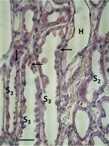 Figure 9 A freeze-substituted and PAS-stained kidney two days following a heavy salt loading of short duration (Group 2F).