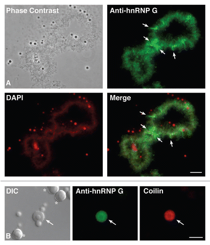 Figure 1 Subnuclear distribution of hnRNP G in Xenopus oocytes. (A) phase contrast and corresponding fluorescent micrographs of one LBC from a nuclear spread that was stained with an autoimmune serum directed against hnRNP G (green). Note that most LBcs loops, which are visible by phase contrast (RNAPII transcription units), are labeled. arrows indicate loops with a particularly strong labeling. DNA was counterstained with DAPI, pseudo-colored in red. Note that the axes of both homologues forming an LBC appear as linear arrays of condensed chromatin granules. The lateral loops are only weakly labeled as they correspond to highly decondensed chromatin fibers. In addition, non chromosomal organelles containing DNA (nucleoli) and/or high concentration of RNAs (nucleoli and nuclear speckles) are also well labeled by DAPI. (B) Magnified view of a nuclear spread to show several non-chromosomal organelles, including nucleoli (asterix) and a Cajal body (arrow), which are readily distinguishable by DIC. In this preparation, the anti-hnRNP G serum stains CBs (green), which were identified using the monoclonal antibody mAb H1 directed against the protein coilin. scale bars are 10 µm.