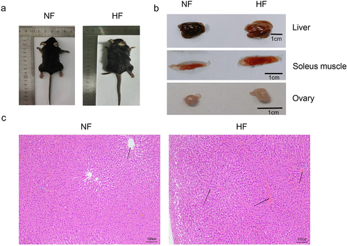 Figure 1. Body and organ changes of mice in the two groups after 12-week feeding. a: images of extrinsic feature of mice in the two groups after 12-week feeding. b: images of extrinsic feature of liver, soleus muscle and ovary organs of mice in the two groups after 12-week feeding. c: H&E staining of liver tissue of mice in the two groups after 12-week feeding. NF group, normal diet group; HF group, high-fat and high-sugar diet group.