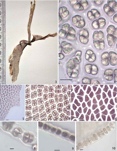 Figs 3–10. Habit and anatomy of Phycocalidia sukshma. Fig. 3. Habit. Fig. 4. Surface view of blade showing spermatangia. Fig. 5. Spinulose margin of the thallus. Fig. 6. Surface view of blade showing zygotosporangia. Fig. 7. Surface view of blade showing vegetative cells. Fig. 8. Cross-section of blade through zygotosporangia. Fig. 9. Cross-section of blade through vegetative cells. Fig. 10. Cross-section of blade through spermatangia. Scale bars = 10 µm