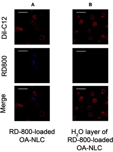 Figure 7 NLC uptakes by neutrophils.Notes: Neutrophils (1.8×107 cells/mL were co-incubated with (A) rhodamine 800 labeled-OA-NLC, and (B) H20 layer of rhodamine 800-loaded OA-NLC after configuration, at 37 °C for 5 min. The intracellular fluorescence signal was then observed by CLSM. (A) Fluorescence signals were observed throughout the neutrophil cytoplasm. Scale bar, 20 μm.Abbreviations: CLSM, confocal laser scanning microscopy; NLC, nanostructured lipid carriers; OA-NLC, oleic acid within nanostructured lipid carriers.