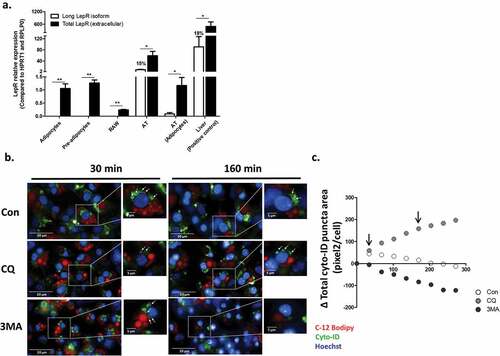 Figure 1. Leptin receptor isoforms expression and live-cell imaging of autophagosome dynamics in differentiated adipocytes. (a) The expression of total (black bars) and long (ObRb, white bars) LepR isoforms mRNA was measured in murine adipocyte cell-line (pre and after differentiation), RAW264.7 murine macrophages cell-line, mice adipose tissue (whole tissue and adipocytes fraction) and liver (positive control), using primers directed to the extracellular domain or the intracellular domain of ObRb, respectively. Results are presented as fold expression from adipocytes cell line (n = 4). Values are mean ± SEM. Means were compared by Mann-Whitney t-test. *p < 0.05, **p < 0.01. (b) Live-cell imaging (Operetta high throughput imaging system) of differentiated murine adipocyte cell-line stained with CYTO-ID (green) to detect autophagosomes (white arrows), in BODIPY-C12 (red, to stain lipid-droplets) – positive cells, and Hoechst (blue) to stain nuclei. Cells were treated with or without CQ (10 μmol/l) to inhibit autophagosome degradation, or with 3-methyladenine (3MA, 5 mmol/l) to inhibit autophagosome biogenesis. Scale bar, 20 μm and 5 μm in zoomed-in images. Shown are representative images. (c) Quantification of mean total autophagosome area per cell in BODIPY-C12 positive cells over time was done semi-automatically by following CYTO-ID punctae area using Columbus software. Black arrows correspond to the time-points shown in B.