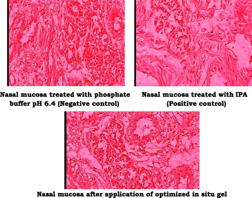 Figure 11. Histopathology of nasal mucosa.