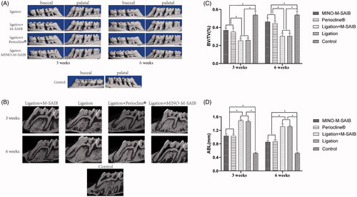 Figure 5. (A) Three-dimensional micro-CT images (buccal and palatal view) of the maxilla first molars alveolar bone level in different groups at 3 weeks and 6 weeks. (B) Bi-dimensional(2D) images of the maxilla first molars alveolar bone level in different groups at 3 weeks and 6 weeks. (C) Analysis of micro-CT volumetric parameters: bone volume/tissue volume (BV/TV) at 3 weeks and 6 weeks. (D) Analysis of micro-ct linear bone loss: alveolar bone loss (ABL) at 3 weeks and 6 weeks. The data represented the mean ± SD, n = 5, *p < .05.