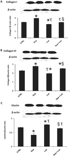 Figure 2  . Immunoblot analysis and densitometric quantification of collagen I (A) and III (B) and elastin (C) in the aorta from control and treated rats. Values are presented here as ratio of collagen I, collagen III or elastin content to β-actin. Data are mean ± SEM; n = 10 in each group. *p < 0.05 (versus CRTL), τp < 0.05 (versus Gua group), §p < 0.05 (versus Los group). CTRL: control group, Gua: sympathectomy group, Los: losartan-treated group, Gua + Los: combined treatment group.