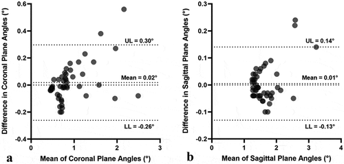 Figure 3. Bland-Altman plots comparing the difference for the two angles and the limits of agreement. A – coronal plane. B – sagittal plane. only shaft lengths of 50 mm or greater are presented due to the noted variability at shorter lengths. UL, upper limit; LL, lower limit