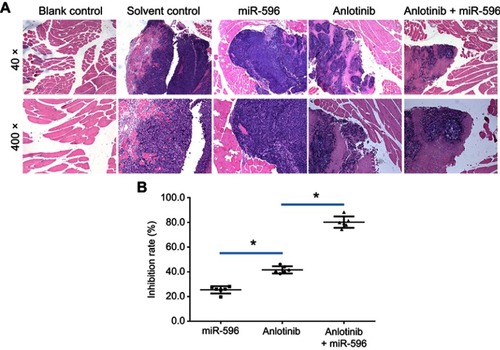 Figure 9 miR-596 enhances the antitumor effect of anlotinib on U2OS cell growth in muscle tissues. U2OS cells transfected with control, miR-596, or miR-596 + SurvivinMut were injected into muscle tissues to form tumor lesions. Four days to 5 days after intramuscular injection of U2OS cells, mice received oral administration of 1mg/kg dose of anlotinib once per 2 days. After 10 treatments, mice were harvested, and muscle tissues were harvested for H&E staining. Results were shown as (A) images from H&E staining and (B) inhibition rates of anlotinib on intramuscular growth of U2OS cells. *P<0.05.Abbreviation: miR, microRNA.