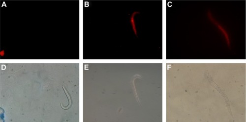Figure 2 Microscope images (400× magnification) of worms exposed to RhoB-labeled Mel-LNC.Notes: (A) Control worm (treated with saline solution). (B) Worm fluorescence image after 30 minutes of treatment, indicating an oral uptake. (C) Fluorescence image of worm 3 hours posttreatment, showing the distribution in the worm body. (D–F) Phase contrast microscopy images of worms; images were acquired at 400× magnification.Abbreviations: Mel-LNC, melatonin-loaded lipid-core nanocapsules; RhoB, Rhodamine B.