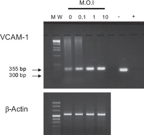 Figure 1. Expression of VCAM-1 mRNA in TMEV-infected astrocytes. RNA from astrocytes mock-infected (0) or infected at a m.o.i. of 0.1, 1, and 10, 24 h postinfection, were reverse transcribed and PCR amplified by using mouse VCAM-1 primer pairs. MW: DNA molecular weight markers (pBR322 DNA-MspI digest); −: negative control where the reverse transcriptase was omitted; +: positive control provided by the kit and producing a band of 300 base pairs. β-Actin primers were used as a house keeping gene positive control and compared with DNA molecular weight markers VIII (Roche Diagnostics, Manheim, Germany).