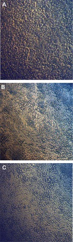 Figure 10 Inverted light micrographs of Caco-2 cells.Notes: Morphological changes in Caco-2 cells before and after being treated with SNPs. (A) Control, (B) Caco-2 cells treated with IC25 SNPs (75 µg/mL), (C) Caco-2 cells treated with IC50 SNPs (150 µg/mL).Abbreviation: SNPs, silver nanoparticles.