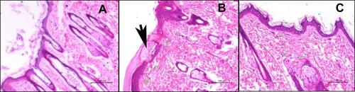 Figure 9 Light photomicrographs showing histopathological sections of (A) rat skin of the control group, (B) rat skin of tretinoin cream treated group, and (C) rat skin of ethosomal RP hydrogel treated group. (H&E stain; Bar= 100μm).