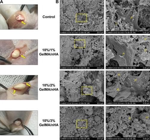 Figure 4 Gross observation and SEM examination of implantation in nude mice after 8 weeks.Notes: (A) Gross examinations of implants harvested 8 weeks after implantation. Capillaries could be seen in 1%, 2% nHA, and the control groups (arrows). (B) SEM figures of implants. Images on the right side are the magnification (×1,000) of the yellow dashed squares on the left images (×200).Abbreviations: C, collagenous fibers; H, nano-hydroxyapatite; P, periodontal ligament stem cells; R, red blood cells; GelMA, gelatin methacrylate; nHA, nanohydroxylapatite; SEM, scanning electron microscopy.