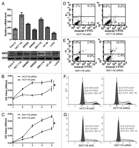 Figure 2. Knockdown of TMPRSS4 suppressed cell proliferation. (A) mRNA (upper) and protein (lower) expression of TMPRSS4 in different CRC cell lines. (B and C) The proliferation rates of HCT116 and SW1116 cells were reduced after TMPRSS4 knockdown. (D and E) Induction of cell apoptosis after TMPRSS4 knockdown in HCT116 and SW1116 cells. (F and G) No significant changes of cell cycle were seen in HCT116 and SW1116 cells. (*P < 0.05)