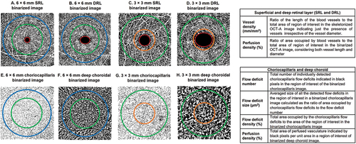 Figure 1. Binarized superficial and deep retinal layer (SRL and DRL), choriocapillaris and deep choroidal layer en face image of 6 × 6 mm and 3 × 3 mm scan sizes and definitions of the outcome indices extracted from the retinal and choroidal images. The SRL extends from the internal limiting membrane to the inner plexiform layer and the DRL extends from the inner nuclear layer to the outer plexiform layer. The choriocapillaris extends from 29 µm to 49 µm beneath the RPE and the deep choroid extends from 64 µm to 115 µm below the RPE. Foveal avascular zone- inside central red circle in the SRL and DRL images a to D; central/foveal zone- inside orange circle (images C,D,G and H); parafoveal zone - region between orange and green circles (images C,D,G and H); perifoveal zone - region between green and blue circles (images A,B,E and F).