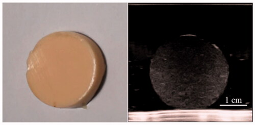 Figure 3. The gross specimen (about 3 cm diameter) and ultrasound image of the normal tissue phantom sample.