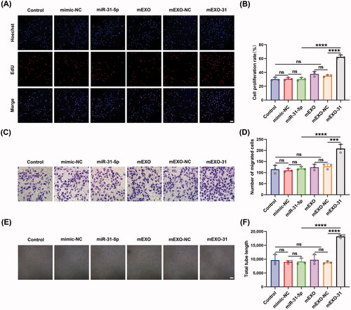 Figure 7. mEXO-31 promoted endothelial cell proliferation, migration, and angiogenesis in vitro. (A,B) EdU assay analysis of the proliferation rate of HUVECs in different treated groups The proliferative cells and cellular nuclei were stained with red and blue colors. Scale bar, 50 μm. (C,D) Images of migrated HUVECs in each group. Scar bar, 50 μm. (E,F) Images of tube formation of HUVECs in each group. Scar bar, 100 μm. n = 3, ns: no significant, ***p < .001, ****p < .0001. Data were presented as mean ± SD. One-way ANOVA with Tukey post-hoc test was used.