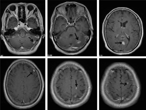 Figure 2 MRI images.