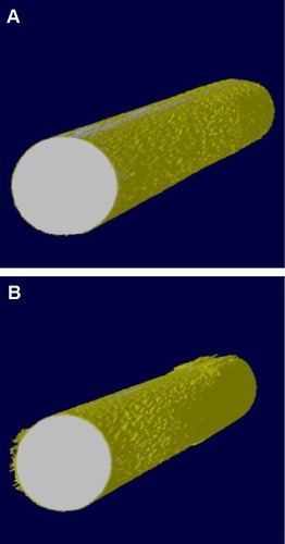Figure 10 Reconstruction of implants based on Micro-CT.Notes: Ti (A), USP-Ti (B).Abbreviations: USP-Ti, Ti surface subjected to USP; USP, ultrasonic shot peening; Ti, titanium.