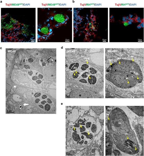 Figure 3 . T. gondii cyst formation in human cerebral organoids. Representative fluorescence image of cyst-like structures in an organoid infected with (A) ME49 and (B) RH. Images of transmission electron microscopy of (C–D) ME49- and (E) RH-infected cerebral organoids. Scale as indicated with the bar. PVM, parasitophorous vacuole membrane; Nu, nucleus; Rh, rhoptry; Co, conoid; Mt, mitochondrion; Dg, dense granule; and Am, amylopectin.