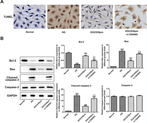 Figure 8 EGCG alleviates the apoptosis of hyperglycemia-induced vascular endothelial cells by activating the PI3K/AKT pathway. (A) The apoptosis of HG-treated HUVECs affected by EGCG and LY294002 was analyzed by TUNEL assay. (B) The expression of bcl2, bax, cleaved-caspase3 and caspase3 in HG-treated HUVECs affected by EGCG and LY294002 was detected by Western blot analysis. *P<0.05, **P<0.01 and ***P<0.001 vs Normal group. ##P<0.01 and ###P<0.001 vs HG group. ∆∆P<0.01 vs EGCG50μM group.