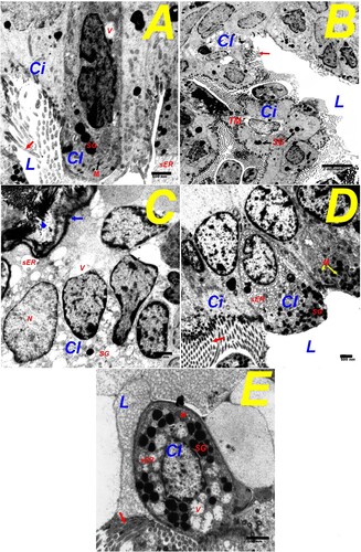 Figure 9. Transmission electron-micrograph of terminal bronchial Clara cells in the lungs of different study groups (Uranyl acetate & Lead citrate stain). (A) The CON group shows the bronchial epithelial lining of the terminal bronchiole comprising ciliated cells (Ci) and Clara cells (Cl). Clara cells formed and bulging apex protrude towards the bronchial lumen (L) and the main body. The apex contains smooth endoplasmic reticulum (sER), pale elongated mitochondria (M) and dense secretory granules (SG), while the main body contains a notched vesicular nucleus (N) and some (SG). Ciliated cells have cilia directed towards the airway lumen (a red arrow). (B) The URT group showing tumour mass (TM) of a closely packed group of pleomorphic cells with characteristic dense secretory granules (SG), pleomorphic nuclei and distorted cell boundaries. Ciliated cells have cilia directed towards the airway lumen (a red arrow). (C) The URT group shows a magnified part of Clara cells with pleomorphic nuclei (N) surrounded by pale cytoplasms, a few dense secretory granules (SG) and many ruptured smooth endoplasmic reticulums (sER). Cells do not rest on the basement membrane (a blue arrow) with underlying collagen fibres (an arrowhead). Ciliated cells have cilia directed towards the airway lumen (a red arrow). (D) The URT + PE-treated group shows almost restoration of the bronchial epithelial lining of the terminal bronchiole comprising ciliated cells (Ci) and Clara cells (Cl). Clara cells formed and bulging apex protrude towards the bronchial lumen (L) and the main body. The apex of Clara’s cell contains electron-dense secretory granules (SG) and mitochondria (M). The main body of Clara cell contains a vesicular basal central nucleus (N) surrounded by smooth endoplasmic reticulum (sER). The ciliated cell has cilia directed towards the lumen (a red arrow). (E) The URT + CIS-treated group shows more or less restoration of Clara cells (Cl) that protrude larger into the lumen (L). The apex of Clara cell contains some spherical mitochondria (M), electron-dense secretory granules (SG), dilated smooth endoplasmic reticulum (sER), while the main body contains a central round nucleus (N), vacuoles (V) and many (SG). Scale bar = 500 nm, except for Fig. C = 2 µm.