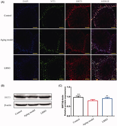 Figure 4. Expression SIRT3 in Sertoli cells in testicular tissue. (A) The location of Sertoli cells was labelled by specific marker WT1, and SIRT3 was localised in testicular tissue by IF. (B) Representative Western blot image of SIRT3. (C) The relative expression of SIRT3 in testicular tissue. Densitometry was used to compare the expression levels. β-Actin was used as an internal loading control. All data were expressed as the mean ± SD, n = 10; **p < 0.01, ***p < 0.001, compared to the ageing model.