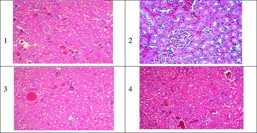 Figure 5. Typical kidney tissue alterations verified in rats treated with AMB or its equivalent dose as 1.0 mg/kg of body weight as iv administration of different Amb-PLGAPEG copolymer. 1) normal kidney tissue; 2,3,4) Fungizone® f1 and f2, respectively, varying degree of nephrotoxicity necrosis related to iv administration of iv doses (5 mg/kg).