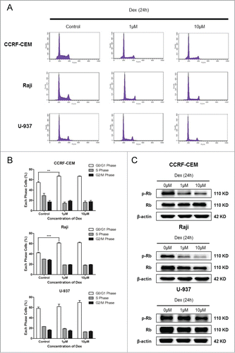 Figure 2. Dex arrests cell cycle in G0/G1-phase. (A, B) CCRF-CEM, Raji, and U-937 cells were treated for 24 h with the indicated concentrations of Dex, fixed, permeabilized, and stained with PI. Flow cytometric analysis of PI-stained cells documented a significant increase in the percentages of CCRF-CEM and Raji cells, but not U-937 cells, arrested in the G0/G1 phase of the cell cycle. Values represent the means ± SD of 3 independent experiments. (Dex versus control: **P < 0.01, ***P < 0.001) (C) Cells were treated with 0, 1, and 10 μM Dex for 24 h, p-Rb and Rb were determined by Western blot.