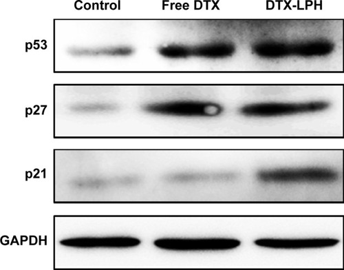Figure 6 Protein quantification of p21, p27, and p53 expression in MDA-MB-231 cells by Western blotting after 24 hours incubation of free DTX or DTX-LPH nanoparticles at DTX concentrations of 10 μg/mL.Abbreviations: DTX, docetaxel; DTX-LPH, docetaxel-loaded lipid polymer hybrid.
