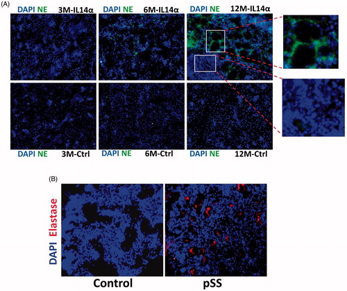 Figure 4. Increased elastase expression in pSS samples as well as in IL14α mice. 10uM sections were obtained from submandibular glands and expression of leucocyte elastase was assessed in control and age-matched IL14α mice (A). Representative confocal images showing staining with elastase antibodies in control and pSS samples are shown in (B). Images shown are representation of three individual samples (three controls and three pSS or IL14-Τγ μιχε) περϕoρμεδ ιν δυπλιχατε.