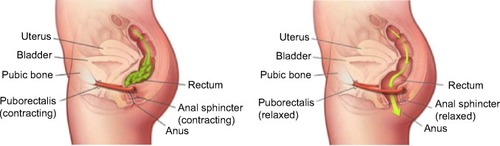 Figure 2 Dynamics of defecation.