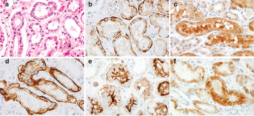 Figure 3. Histopathological and immunohistochemical findings of OAT1-4 and URAT1 in the human kidney. (A) Hematoxylin-eosin staining of a serial section. (B–F) Immunohistochemical findings of OAT1-4 and URAT1. Definitive expressions of all the transporters are observed mainly in proximal renal tubules of the renal cortex. (B and D) The expression patterns of OAT1 and OAT3 are similar, with strong expression along the basement membrane (basolateral membrane) of renal tubules. (C) Diffuse OAT2 expression is observed in the cytoplasm of proximal renal tubular cells. (E) OAT4 is expressed strongly along the luminal brush border (brush border membrane) of proximal renal tubules. (F) URAT1 expression is found in the cytoplasm on the lumen side and in luminal brush border, but the number of positive cells tends to be fewer compared to OAT1–4.