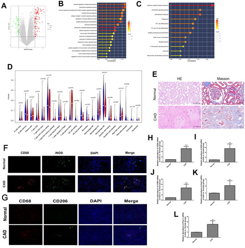 Figure 1. Identification and validation of macrophage polarization in chronic allograft fibrosis. (A) volcano plot of differentiated expressed genes (DGEs) in GSE25902; (B-C) Gene set enrichment analysis of DEGs in GSE25902 in GO (B) and KEGG (C) databases; (D) immune cell infiltration results of DEGs using Cibersort software. The red bars represent the relative abundance of specific immune cells in the CAD group, and the blue bars represent the relative abundance of corresponding immune cells in the stable group; (E) HE and Masson staining results in renal specimens from healthy volunteers (n = 5) and patients with chronic allograft dysfunction (CAD; n = 5); (F-G) Indirect double immunofluorescence staining of CD68(+) iNOS(+) M1 macrophages (F) and CD68(+) CD206(+) M2 macrophages (G) in Normal (n = 5) and CAD (n = 5) groups; (H-L) PCR analysis of CD68 mRNA (H), iNOS mRNA (I), CD86 mRNA (J), Arg-1 mRNA (K), and Fizz1 mRNA (L) in Normal (n = 5) and CAD (n = 5) groups. **p < 0.01 compared to Normal group; ***p < 0.001 compared to Normal group; ****p < 0.0001 compared to Normal group. Each experiment was duplicated at least thrice.