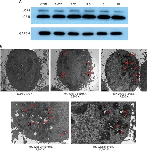 Figure 5 Effect of MK-2206 on autophagy in human nasopharyngeal carcinoma cells.