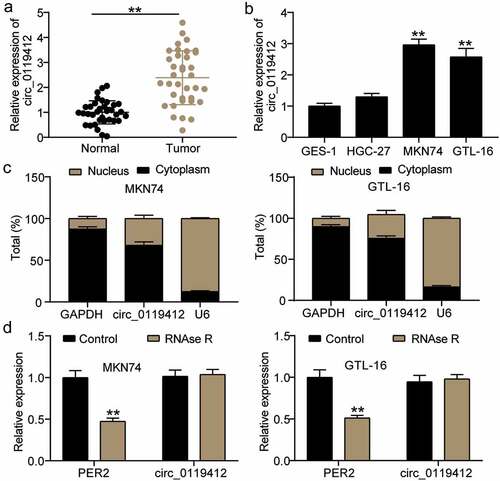 Figure 1. Hsa_circ_0119412 was identified to be highly expressed in GC (a) Relative expression of hsa_circ_0119412 in GC tissues measured by qRT-PCR assay compared to adjacent normal tissues. **P < 0.001. (b) Relative expression of hsa_circ_0119412 in GC cells measured by qRT-PCR assay compared to GES-1 cells. **P < 0.001 compared to GES-1 cells. (c) Nuclear-cytoplasmic fractionation assay showed that hsa_circ_0119412 was mainly localized in the cytoplasm of MKN74 and GTL-16 cells. (d) RNase R treatment was used to evaluate the exonuclease resistance of hsa_circ_0119412 in MKN74 and GTL-16 cells. **P < 0.001 compared to control.