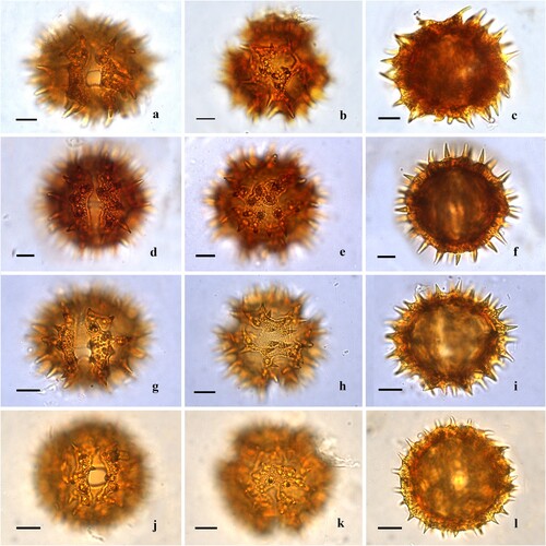 Figure 1. Light microscopy of Centauropsis Bojer ex DC. pollen grains. A‒C. Centauropsis antanossi (Scott Elliot) Humbert. A. Detail of the colporus, endoaperture and surface, equatorial view. B. Apertures 3-colporate, long and acute apices and apocolpium surface. C. Optical section, equatorial view. D‒F. Centauropsis cuspidata Humbert. D. Detail of the colporus, endoaperture and surface, equatorial view. E. Apertures 3-colporate, long and acute apices and apocolpium surface. F. Optical section, equatorial view. G‒H. Centauropsis decaryi Humbert. G. Detail of the colporus, endoaperture and surface, equatorial view. H. Apertures 3-colporate, long and acute apices and apocolpium surface. I. Optical section, equatorial view. J‒L. Centauropsis fruticosa Bojer ex DC. J. Detail of the colporus, endoaperture and surface, equatorial view. K. Apertures 3-colporate, long and acute apices and apocolpium surface. L. Optical section, equatorial view. Scale bars – 10 μm (A‒C, G‒L), 8 μm (D‒F).